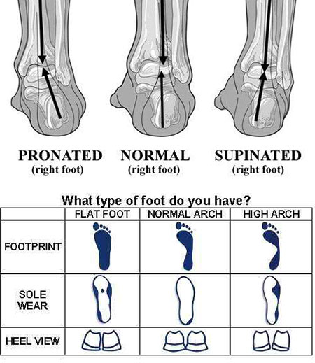 Foot Type Chart - How to Choose Tennis Shoes - Athlete Audit